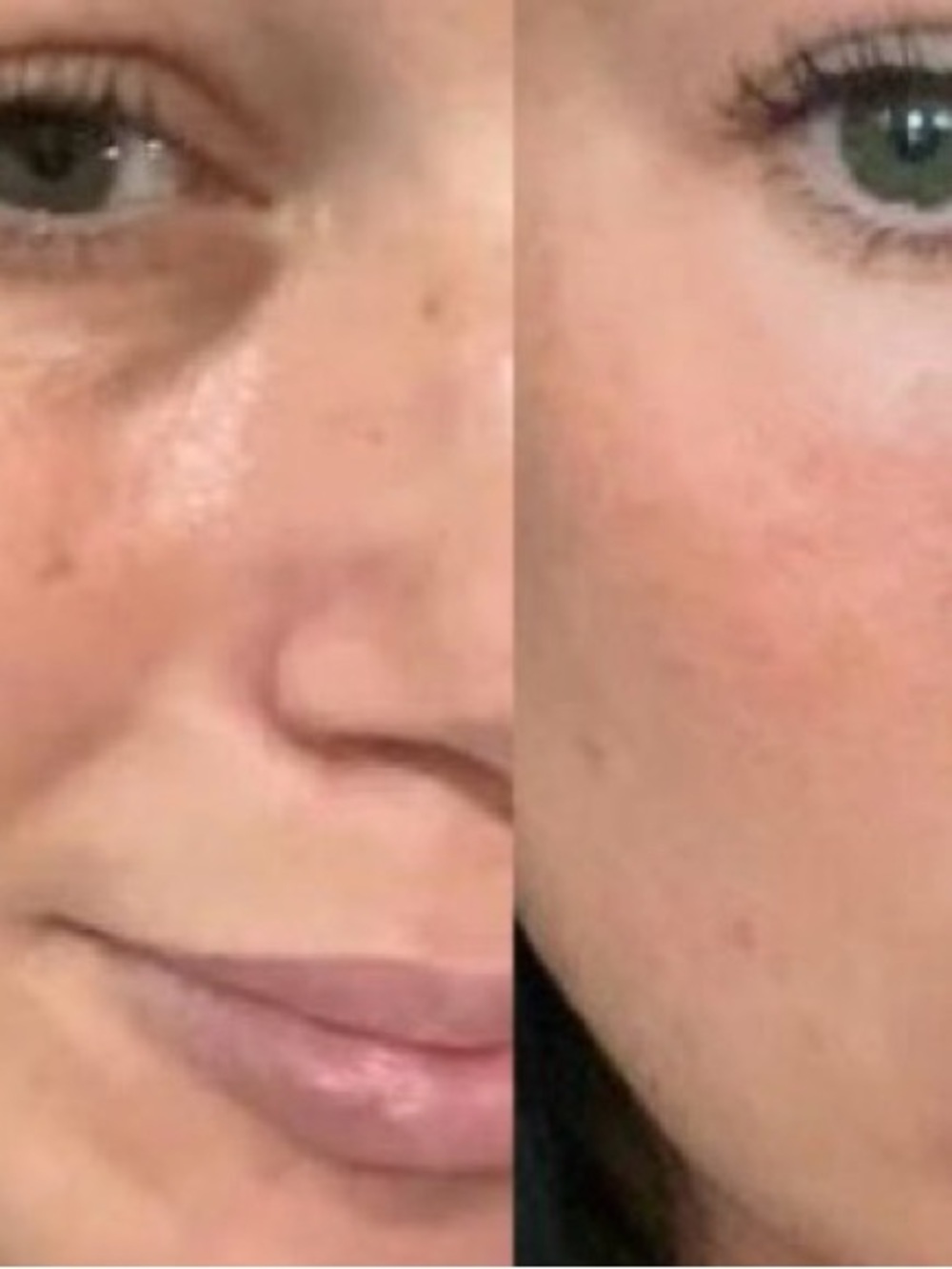 SPF 35 Brightening  Concealer - Lightweight Coverage for Eyes & Face